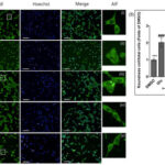 Neuroprotective Effects of Ethanol Extract Polyscias guilfoylei (EEPG) Against Glutamate Induced Neurotoxicity in HT22 Cells